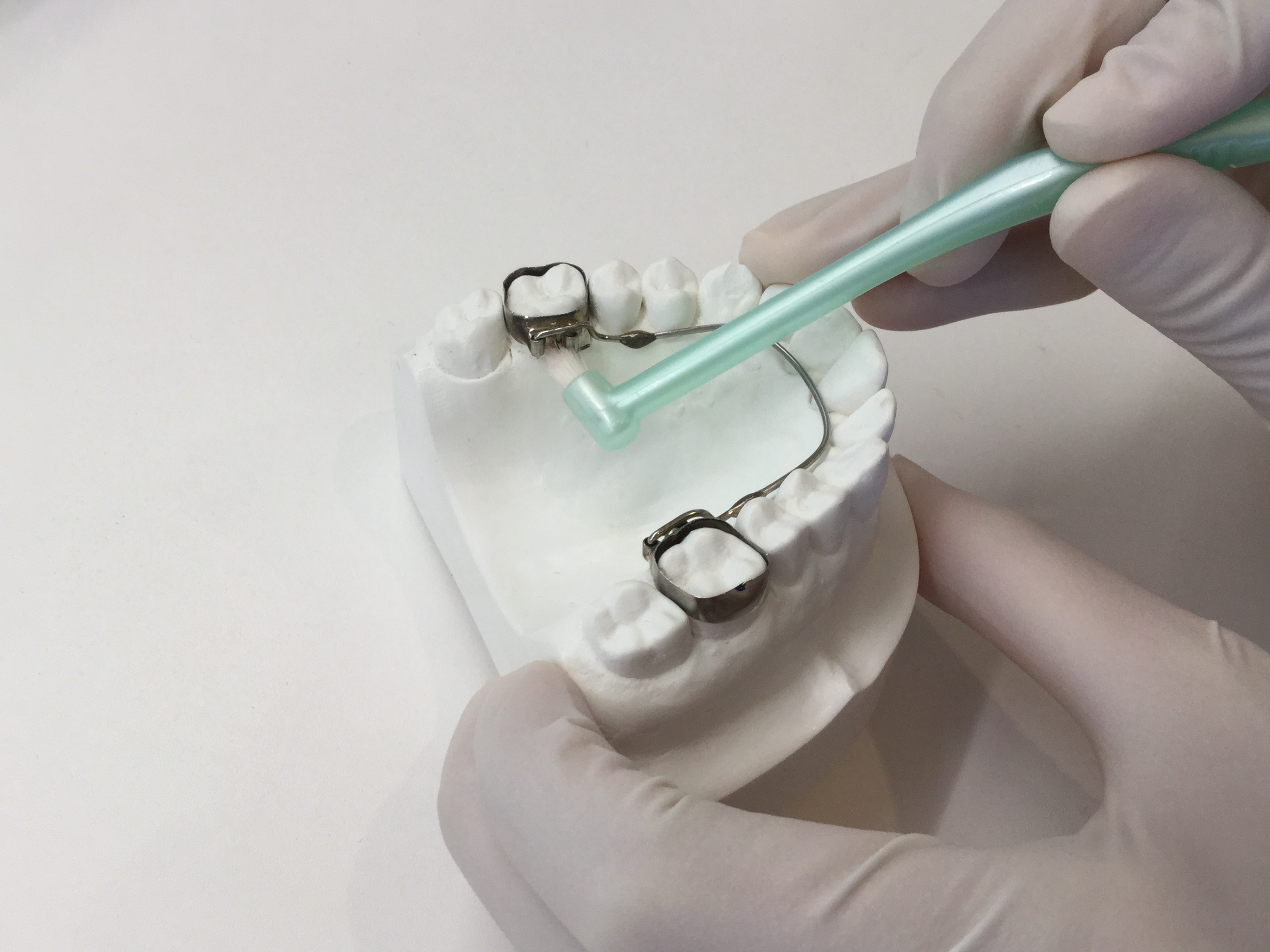 歯科矯正　トミー　バンド　上下左右 歯科矯正 トミー バンド 上下左右 歯科矯正 トミー バンド 上下左右